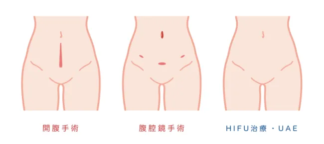 他の治療法との比較イラスト